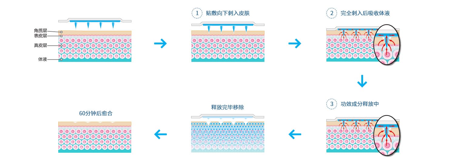 微针作用机制示意图一
